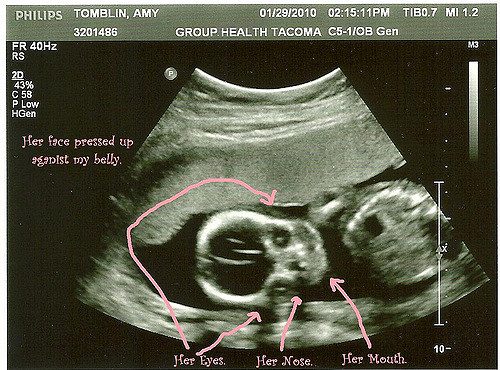 مراحل النمو و التغيرات التي تطرأ على الأم و الجنين في الشهر الخامس من الحمل كبسولة