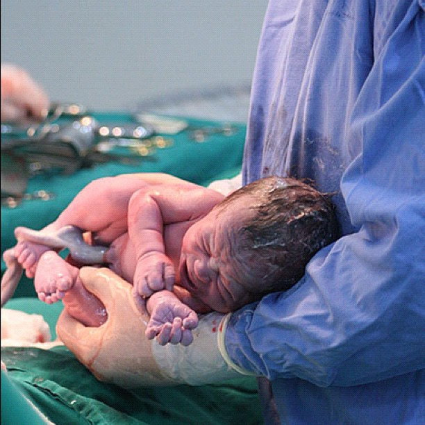 مراحل الولادة القيصرية و نصائح ما بعد الولادة كبسولة