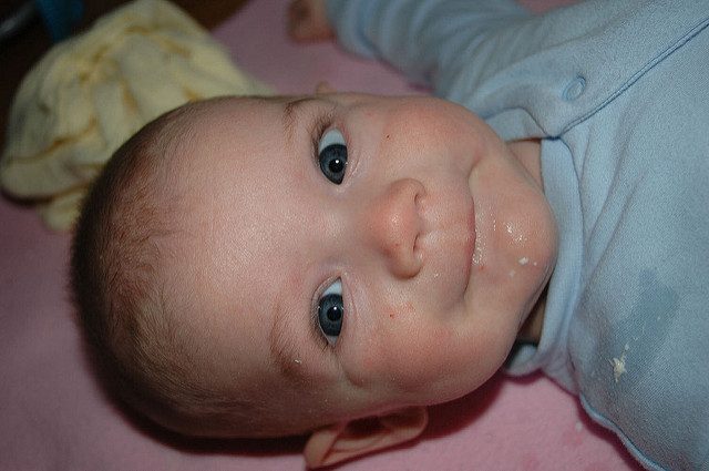 أسباب ارتداد الحليب عند الرضع و أساليب علاجه كبسولة